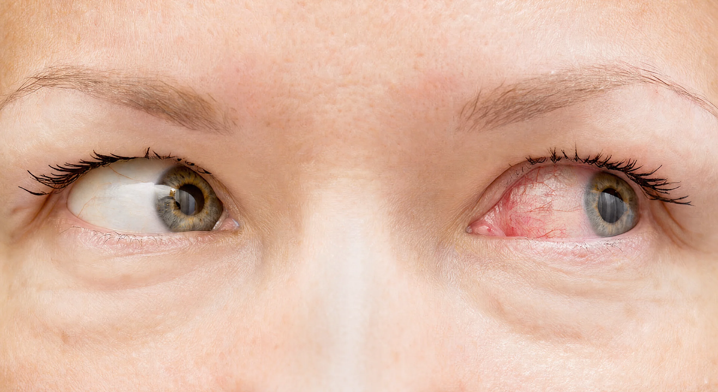 irritated eyes worry.jpg